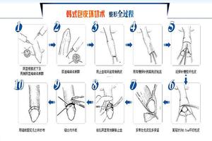 呼市包皮垢多怎么治疗(包头上有很多白色污垢)