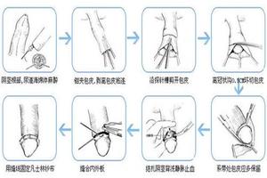 呼市包皮传统手术(呼和浩特包皮环切后睾丸疼)