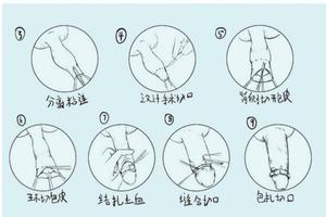 呼和浩特包皮手术术后程序(做包皮手术呼和浩特哪家医院好)